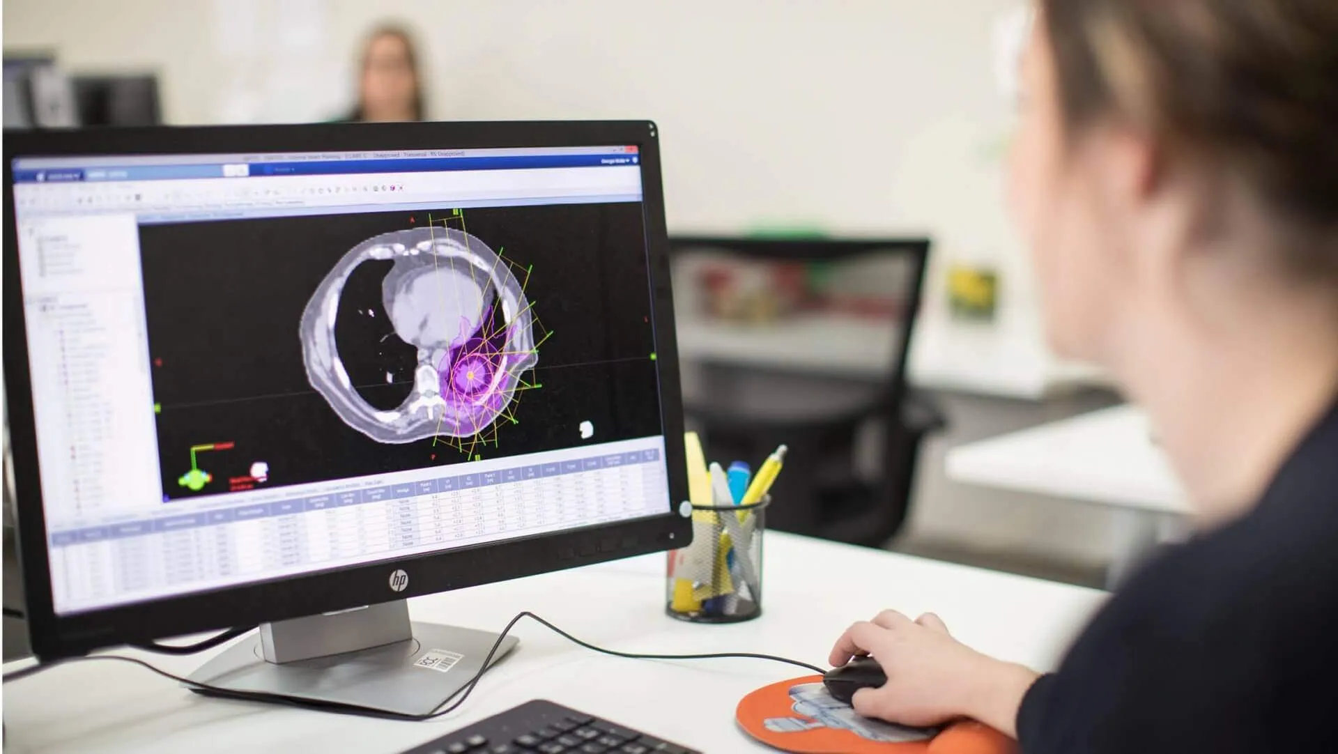 Remote Radiation Therapy Planning: How the Process Works